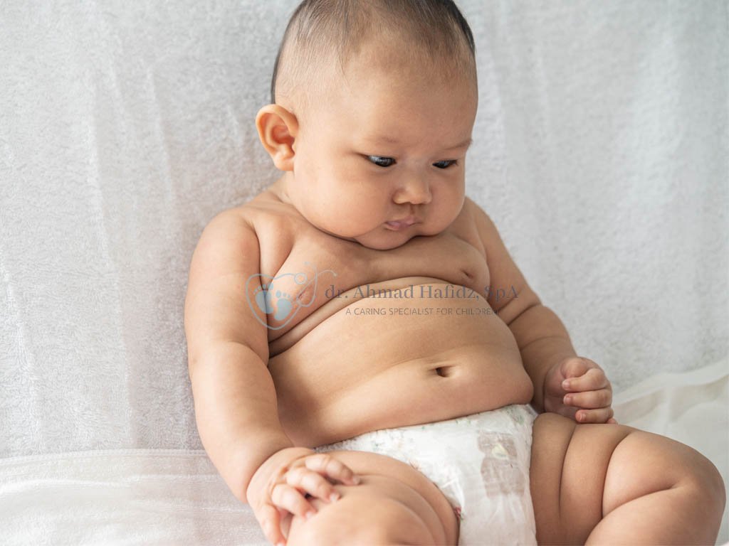 Normalkah Perut Buncit pada Bayi?